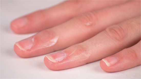 5 Cara Membersihkan Kuku Secara Alami Tanpa Merusaknya