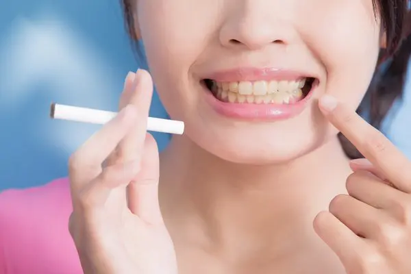 10 Tips Menjaga Kesehatan Mulut untuk Perokok 10 Tips Menjaga Kesehatan Mulut untuk Perokok