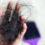 10 Cara Mengatasi Kerontokan Rambut Setelah Melahirkan