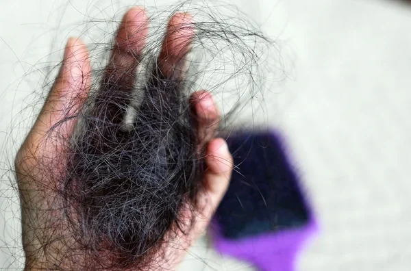 10 Cara Mengatasi Kerontokan Rambut Setelah Melahirkan