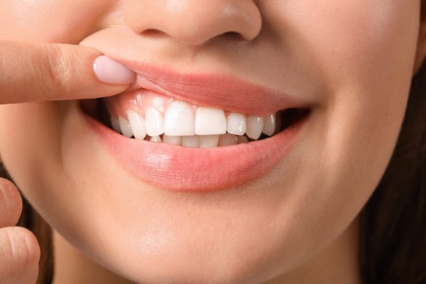 7 Kebiasaan Pagi Hari untuk Gusi Lebih Sehat