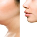 10 Tips Agar Dagu Tidak Menggelambir di Usia Muda