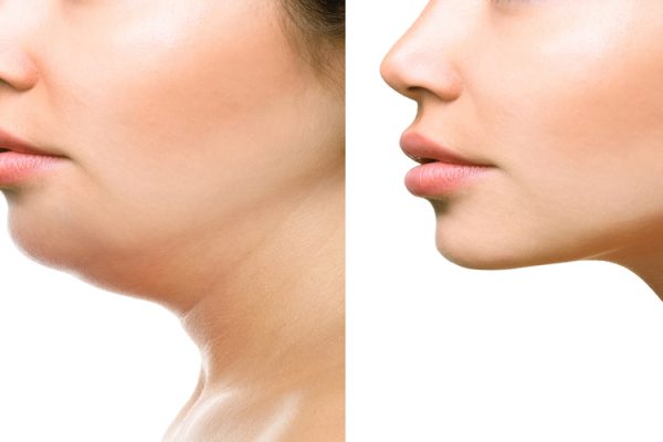 10 Tips Agar Dagu Tidak Menggelambir di Usia Muda